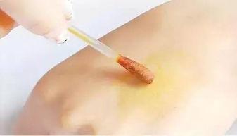 成人伤口视频教程,实用步骤与技巧解析