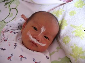 去痱子成人小妙招视频,成人夏日护肤必备！