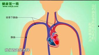 成人胃管植入视频播放,胃管植入操作步骤及要点解析