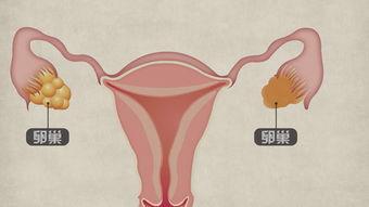 成人胃管植入视频播放,胃管植入操作步骤及要点解析