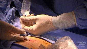 成人胃管植入视频播放,胃管植入操作步骤及要点解析