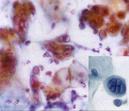 成人怎么去螨虫呢视频,成人如何轻松去除家中螨虫