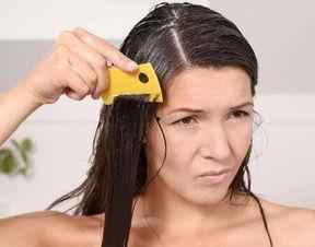 成人头垢去除视频大全,专业视频教程大全解析