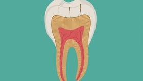 成人补牙流程视频教程